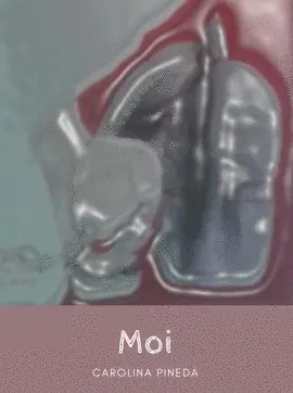 MOI