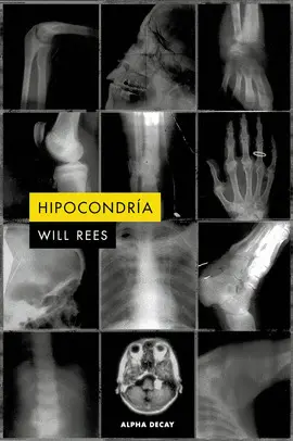 Hipocondria